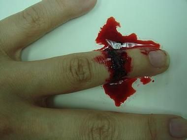 梦到伤口流血是什么意思_梦见自己受伤流血怎么办