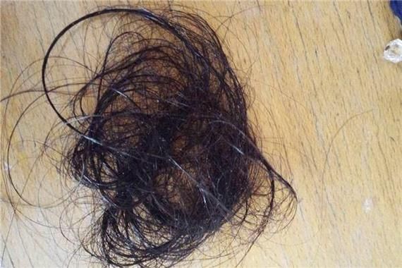 梦到掉头发是什么意思_梦见头发掉了一大把怎么办