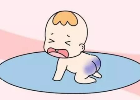宝宝屁股青色多久会消失_新生儿蒙古斑会变大吗