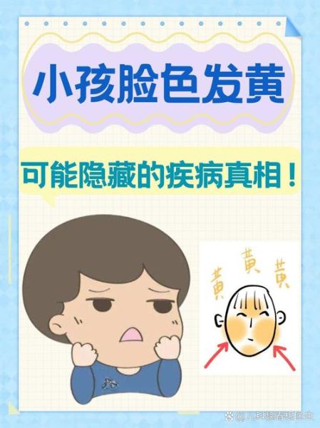 2岁宝宝脸色发黄是什么原因_需要做什么检查
