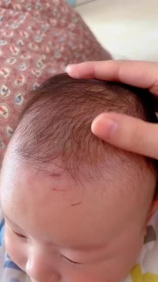 宝宝老抓头是怎么回事_宝宝抓头会秃吗