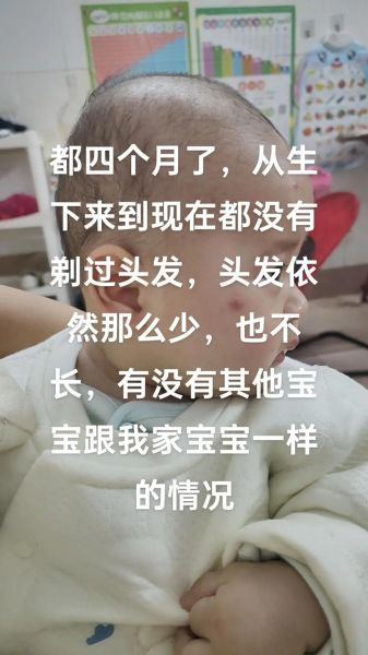 宝宝头发少缺什么_怎么补最快