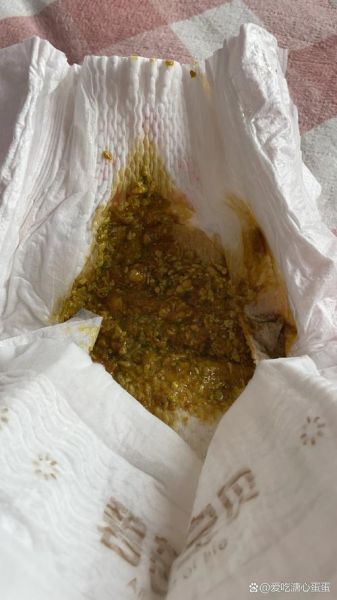 奶粉宝宝大便有奶瓣_需要换奶粉吗
