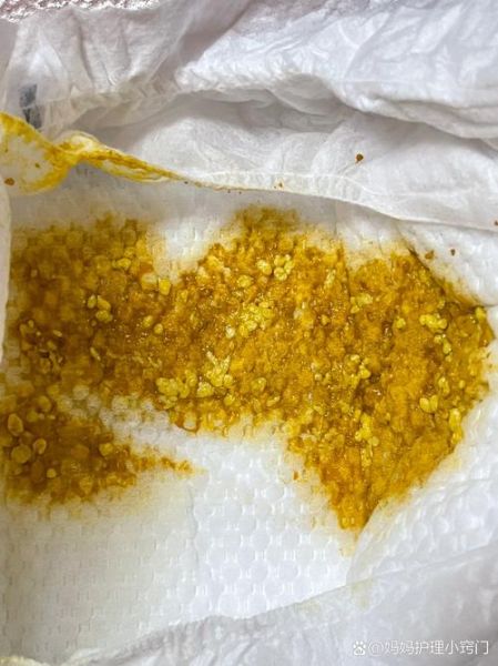 奶粉宝宝大便有奶瓣_需要换奶粉吗
