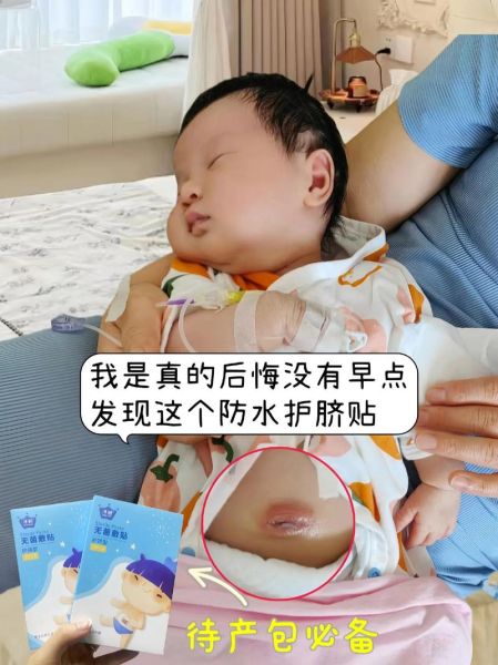 满月宝宝肚脐出血怎么办_满月宝宝肚脐出血正常吗