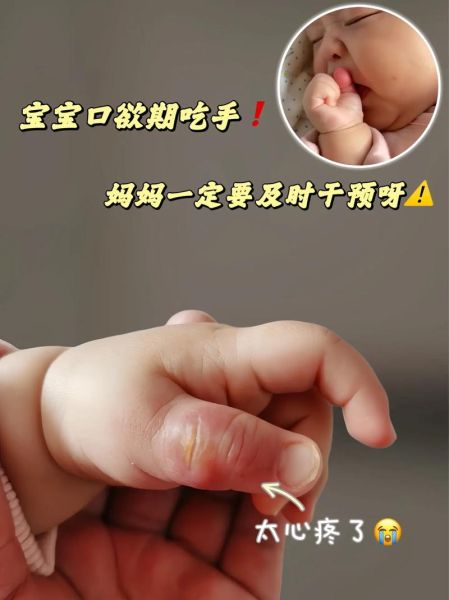 宝宝几个月开始吃手_吃手正常吗