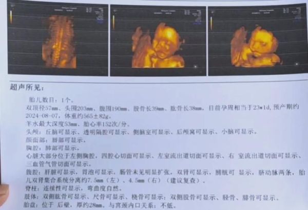 四维宝宝一直趴着不动怎么办_四维检查宝宝不配合怎么调整姿势