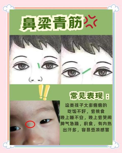 宝宝鼻梁青怎么回事_宝宝鼻梁青需要看医生吗