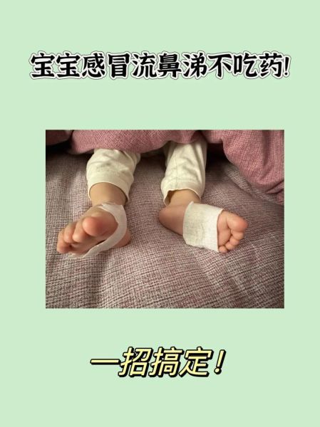 1岁宝宝流黄鼻涕怎么办_需要吃药吗