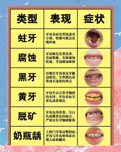 牙齿照片图片大全_如何辨别牙齿问题