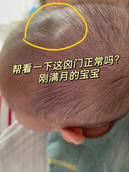 五个月宝宝囟门凹陷怎么回事_怎么判断脱水还是正常