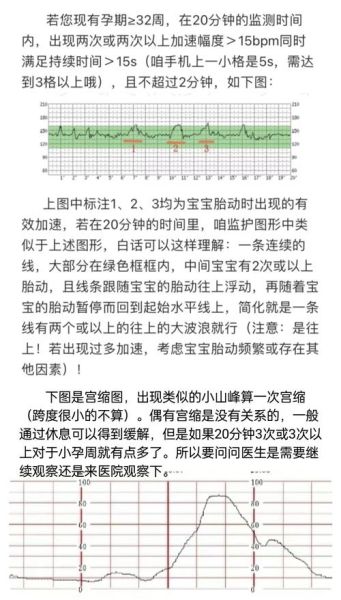 胎心监护宝宝不动怎么办_胎心监护宝宝不动的原因