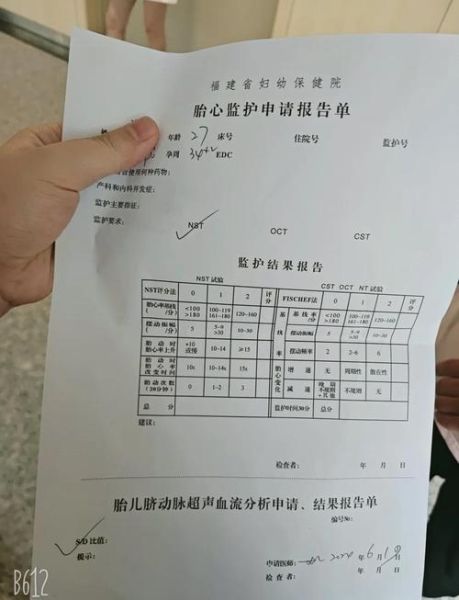 胎心监护宝宝不动怎么办_胎心监护宝宝不动的原因
