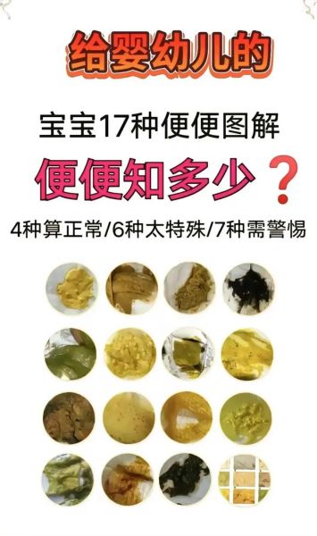 一个月宝宝大便有粘液正常吗_新生儿大便粘液原因
