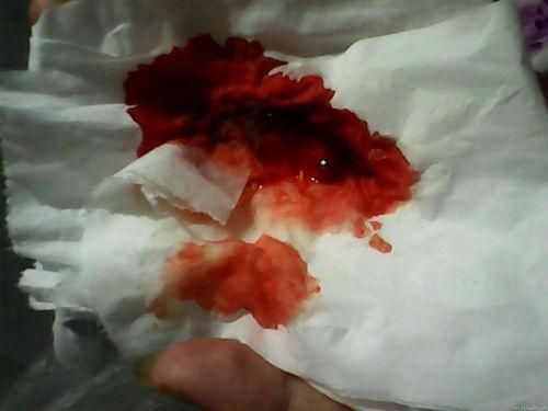 梦到吐血是什么意思_梦见自己吐血是吉是凶