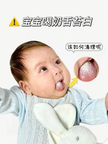 2岁宝宝舌苔厚白是怎么回事_舌苔厚白需要看医生吗