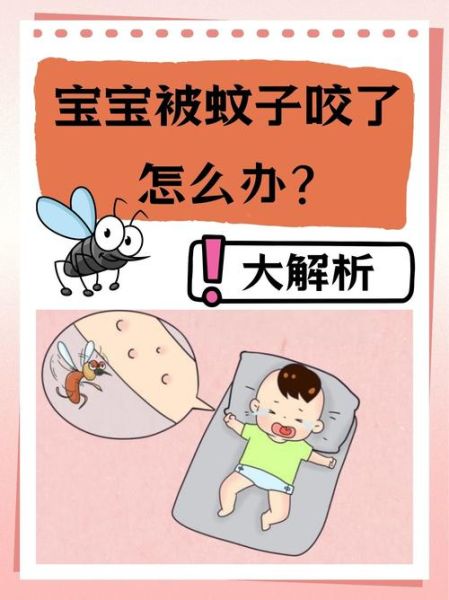4个月宝宝被蚊子咬了怎么办_婴儿蚊子包快速消肿