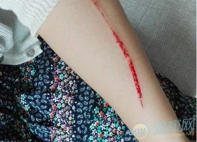 梦到自己手臂受伤流血_周公解梦