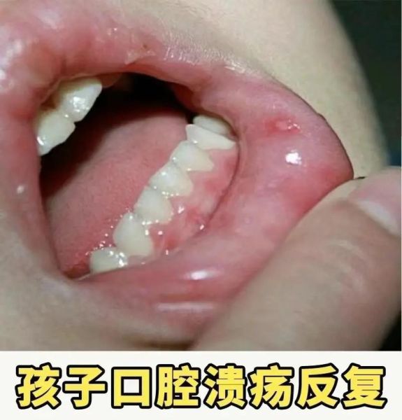 宝宝大便很干怎么办_宝宝大便干硬吃什么好