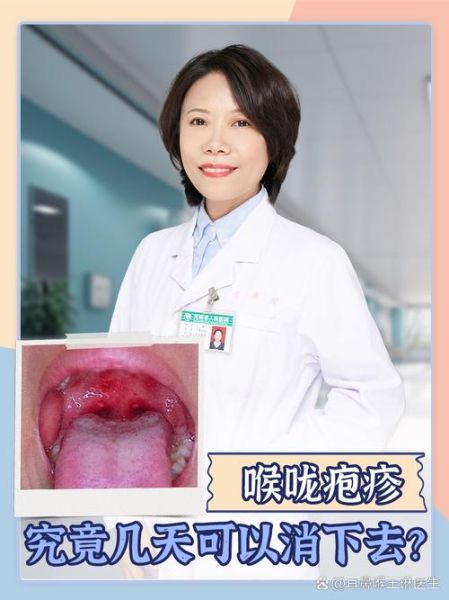 宝宝喉咙长泡发烧怎么办_喉咙疱疹反复高烧