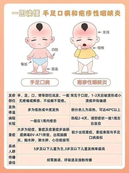 宝宝喉咙长泡发烧怎么办_喉咙疱疹反复高烧