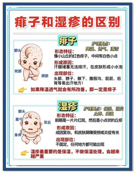 宝宝长痱子怎么办_怎么快速止痒