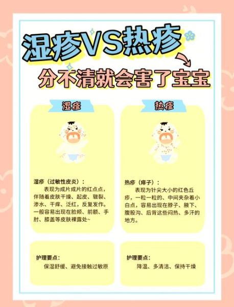 宝宝热疹用什么药膏_热疹和湿疹区别
