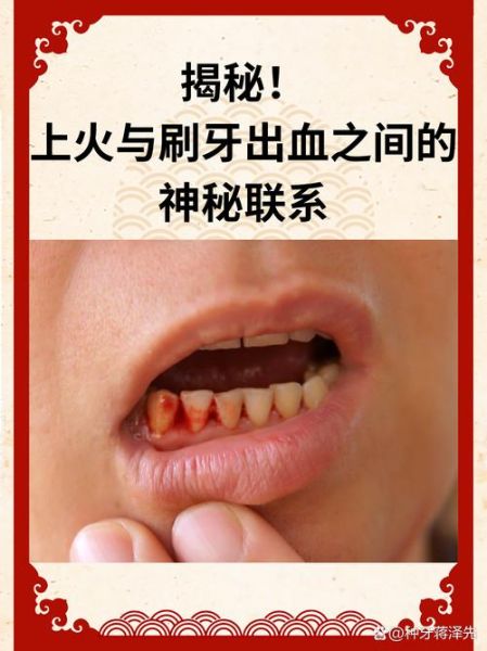 梦到刷牙是什么意思_梦见刷牙出血代表什么