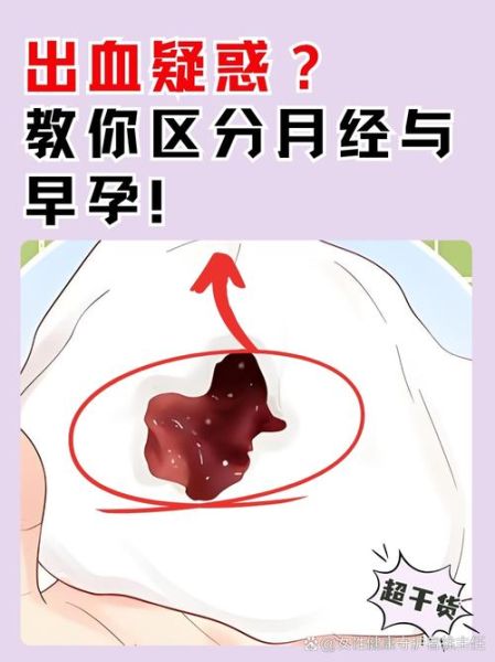 梦到例假血是什么意思_梦见月经血好不好