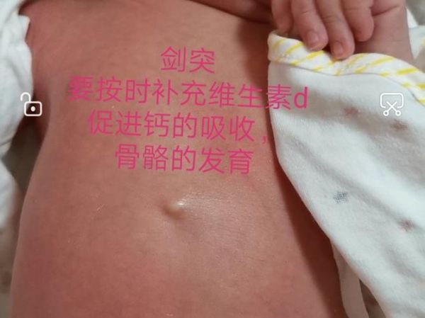宝宝剑突突出正常吗_新生儿剑突骨图片怎么看