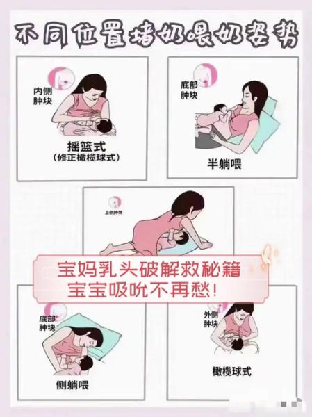 宝宝吸奶后乳房刺痛怎么办_哺乳期乳房刺痛原因