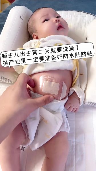 宝宝肚脐化脓怎么办_新生儿脐部护理方法