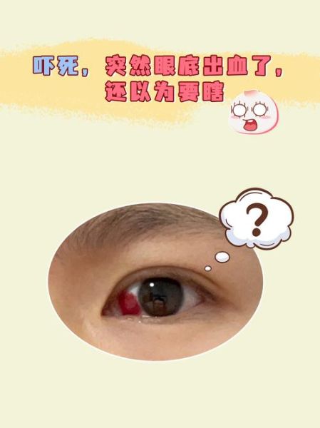 梦见眼睛流血_意味着什么
