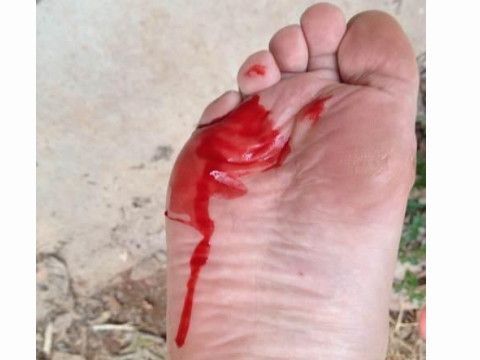 梦到别人的脚是什么意思_梦见他人脚受伤预示什么