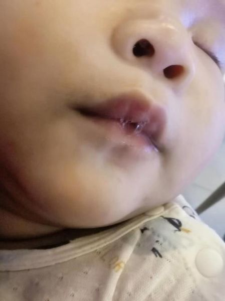 五个月宝宝吐泡泡正常吗_宝宝吐泡泡是肺炎吗