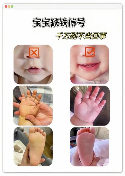 宝宝右手比左手灵活_需要纠正吗