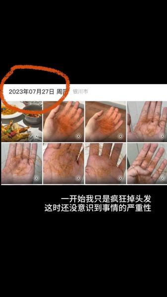 梦到自己秃顶_是什么预兆