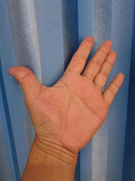 梦到一只手是什么意思_梦见手断了代表什么