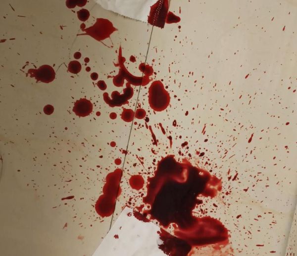 血图片大全_血图片有哪些类型