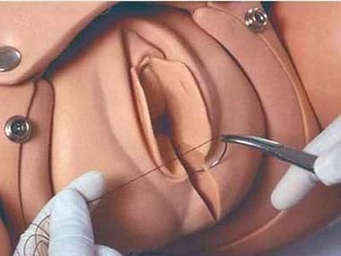 分娩图片大全_真实顺产过程图解