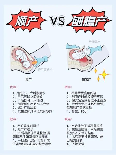 分娩图片大全_真实顺产过程图解