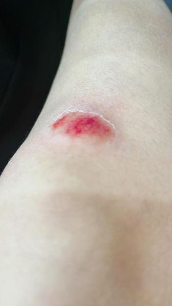 孕妇梦见摔跤预示什么_孕妇梦见摔跤怎么办