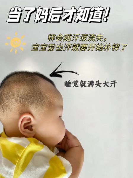 宝宝睡觉额头出汗正常吗_宝宝睡觉额头出汗怎么办