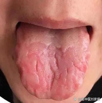 梦到舌头掉了_有什么预兆