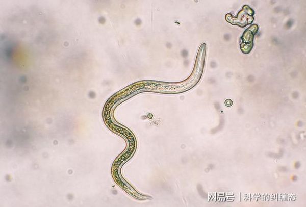 梦到寄生虫是什么意思_如何科学解梦