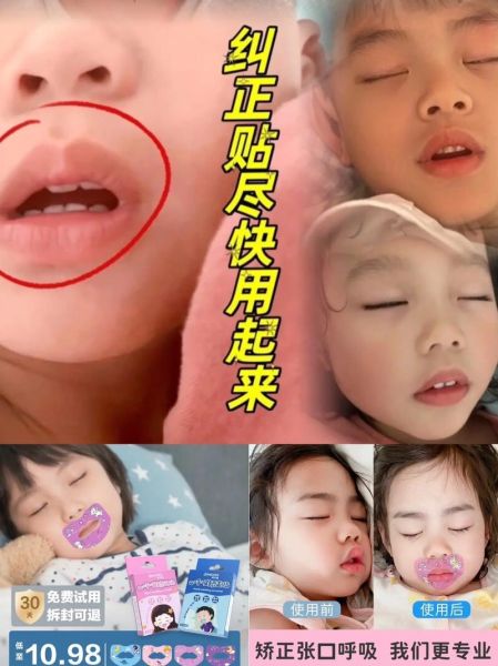 宝宝上嘴唇翘怎么矫正_婴儿翘唇纠正方法