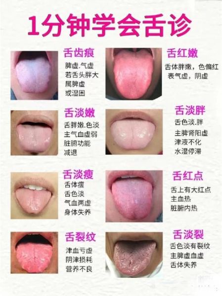 舌头图片大全_正常与异常舌象如何辨别