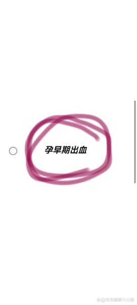 孕妇梦到出血是什么意思_孕妇梦见出血预示什么