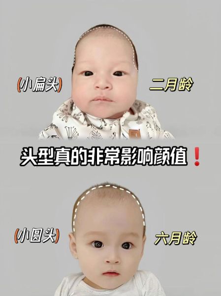 宝宝额头突出高正常吗_宝宝额头突出高图片对比