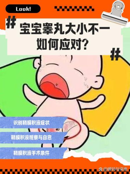 宝宝蛋蛋有积液图片_婴儿睾丸鞘膜积液怎么办